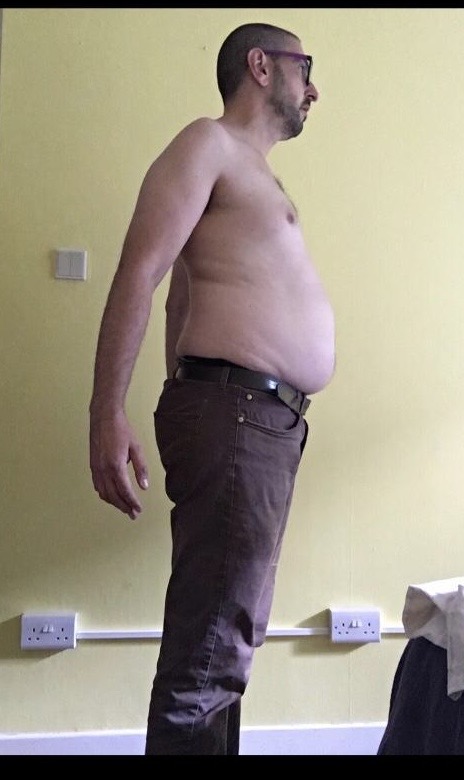 Brett Before - Torso